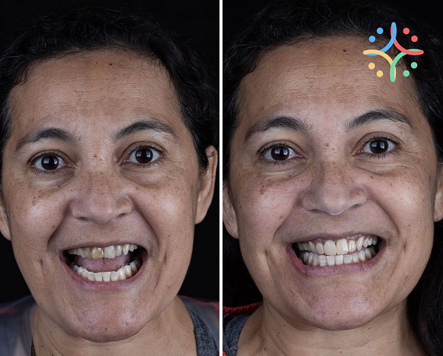 Brazilian Dentist Travels To Treat The Teeth Of Poor People For Free And Here Are 30 Transformations Brazilian Dentist Travels To Treat The Teeth Of Poor People For Free And Here Are 30 Transformations