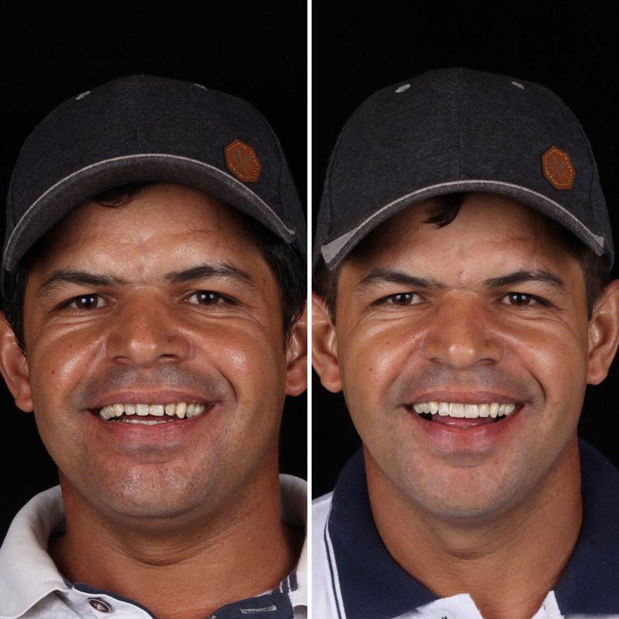 Brazilian Dentist Travels To Treat The Teeth Of Poor People For Free And Here Are 30 Transformations Brazilian Dentist Travels To Treat The Teeth Of Poor People For Free And Here Are 30 Transformations