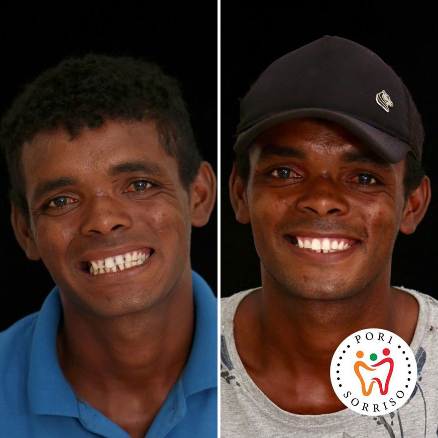 Brazilian Dentist Travels To Treat The Teeth Of Poor People For Free And Here Are 30 Transformations Brazilian Dentist Travels To Treat The Teeth Of Poor People For Free And Here Are 30 Transformations