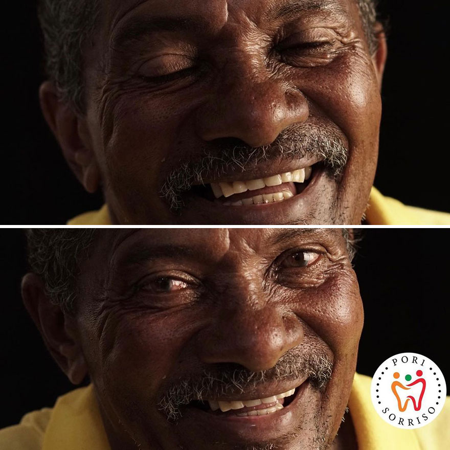 Brazilian Dentist Travels To Treat The Teeth Of Poor People For Free And Here Are 30 Transformations Brazilian Dentist Travels To Treat The Teeth Of Poor People For Free And Here Are 30 Transformations