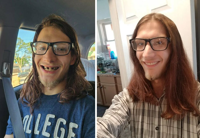 50 Interesting Comparison Images To Give You A New Perspective On Things (New Pics)