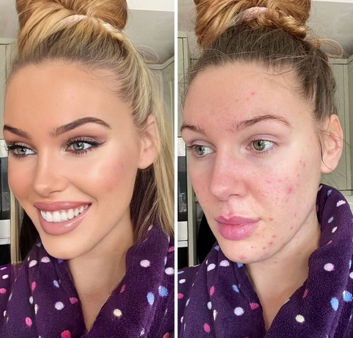 TikToker Goes Viral By Exposing The Truth Behind Heavily-Edited Pictures On Social Media (30 Pics) TikToker Goes Viral By Exposing The Truth Behind Heavily-Edited Pictures On Social Media (30 Pics)