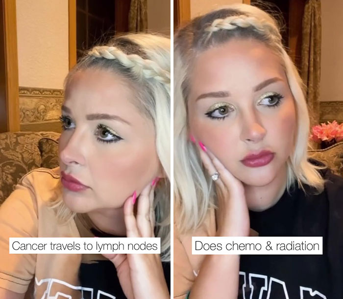 Woman Was Diagnosed With Cervical Cancer 3 Times And Shares The Hard And Joyous Days She Has On TikTok Woman Was Diagnosed With Cervical Cancer 3 Times And Shares The Hard And Joyous Days She Has On TikTok