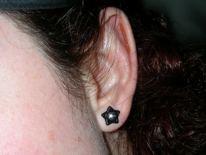 Only People With Rare Body Features Joined This Thread And Shared 35 Of Their Body Anomalies Only People With Rare Body Features Joined This Thread And Shared 35 Of Their Body Anomalies