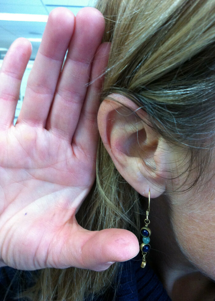 Only People With Rare Body Features Joined This Thread And Shared 35 Of Their Body Anomalies Only People With Rare Body Features Joined This Thread And Shared 35 Of Their Body Anomalies