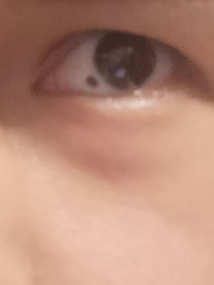 Only People With Rare Body Features Joined This Thread And Shared 35 Of Their Body Anomalies Only People With Rare Body Features Joined This Thread And Shared 35 Of Their Body Anomalies