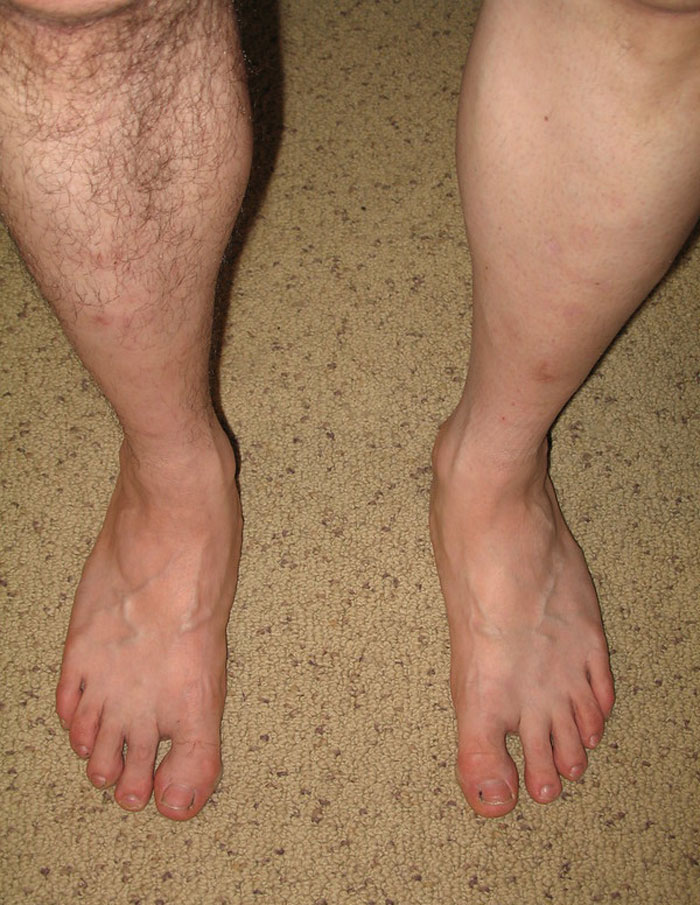 Only People With Rare Body Features Joined This Thread And Shared 35 Of Their Body Anomalies Only People With Rare Body Features Joined This Thread And Shared 35 Of Their Body Anomalies