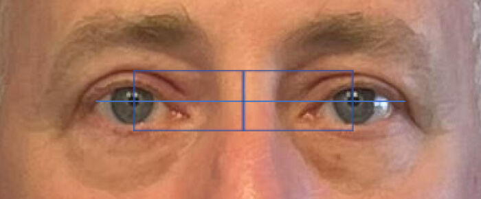 Only People With Rare Body Features Joined This Thread And Shared 35 Of Their Body Anomalies Only People With Rare Body Features Joined This Thread And Shared 35 Of Their Body Anomalies