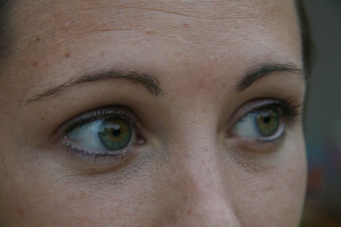 Only People With Rare Body Features Joined This Thread And Shared 35 Of Their Body Anomalies Only People With Rare Body Features Joined This Thread And Shared 35 Of Their Body Anomalies