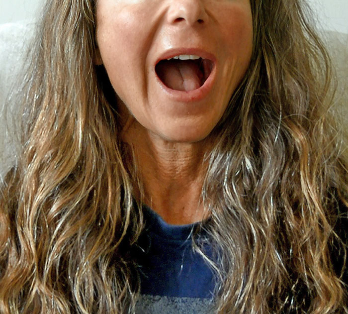 Only People With Rare Body Features Joined This Thread And Shared 35 Of Their Body Anomalies Only People With Rare Body Features Joined This Thread And Shared 35 Of Their Body Anomalies