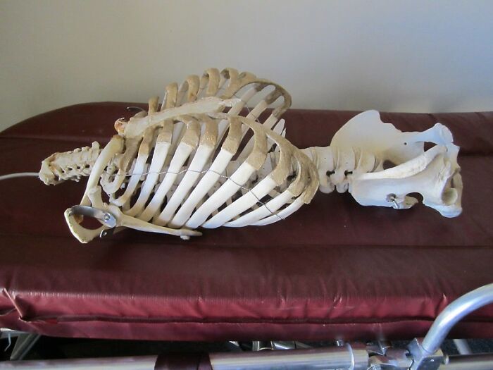 Only People With Rare Body Features Joined This Thread And Shared 35 Of Their Body Anomalies Only People With Rare Body Features Joined This Thread And Shared 35 Of Their Body Anomalies