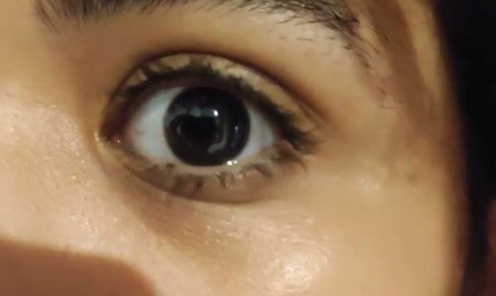 Only People With Rare Body Features Joined This Thread And Shared 35 Of Their Body Anomalies Only People With Rare Body Features Joined This Thread And Shared 35 Of Their Body Anomalies