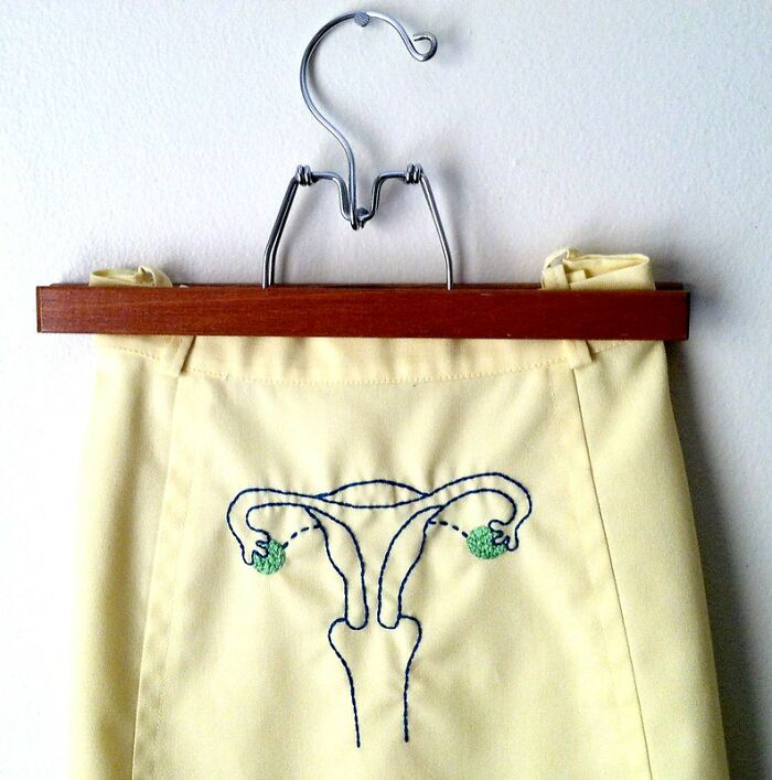 Only People With Rare Body Features Joined This Thread And Shared 35 Of Their Body Anomalies Only People With Rare Body Features Joined This Thread And Shared 35 Of Their Body Anomalies