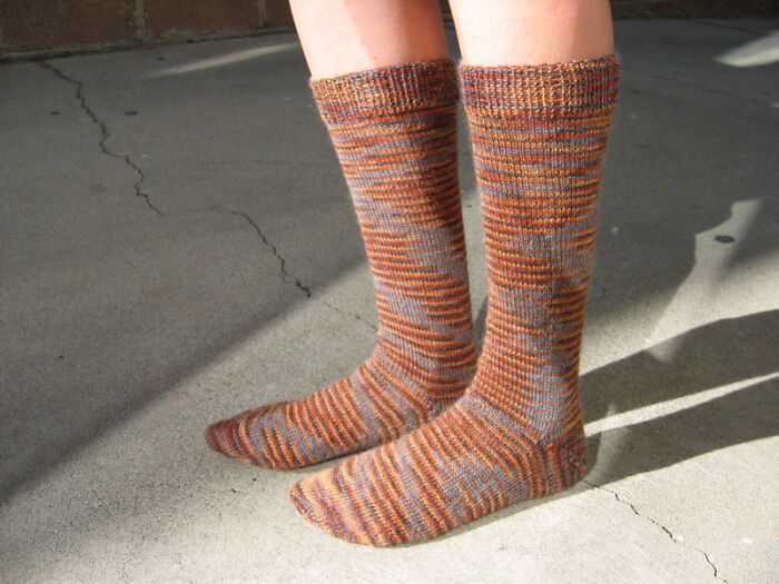 Only People With Rare Body Features Joined This Thread And Shared 35 Of Their Body Anomalies Only People With Rare Body Features Joined This Thread And Shared 35 Of Their Body Anomalies