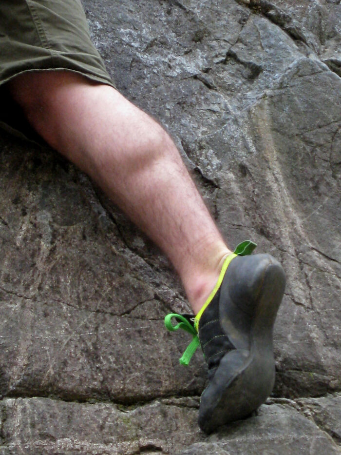 Only People With Rare Body Features Joined This Thread And Shared 35 Of Their Body Anomalies Only People With Rare Body Features Joined This Thread And Shared 35 Of Their Body Anomalies