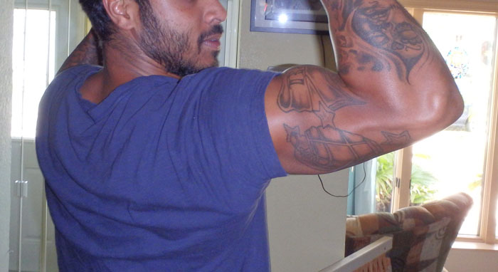 Only People With Rare Body Features Joined This Thread And Shared 35 Of Their Body Anomalies Only People With Rare Body Features Joined This Thread And Shared 35 Of Their Body Anomalies