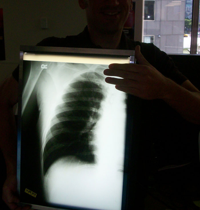 Only People With Rare Body Features Joined This Thread And Shared 35 Of Their Body Anomalies Only People With Rare Body Features Joined This Thread And Shared 35 Of Their Body Anomalies