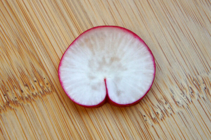 Only People With Rare Body Features Joined This Thread And Shared 35 Of Their Body Anomalies Only People With Rare Body Features Joined This Thread And Shared 35 Of Their Body Anomalies