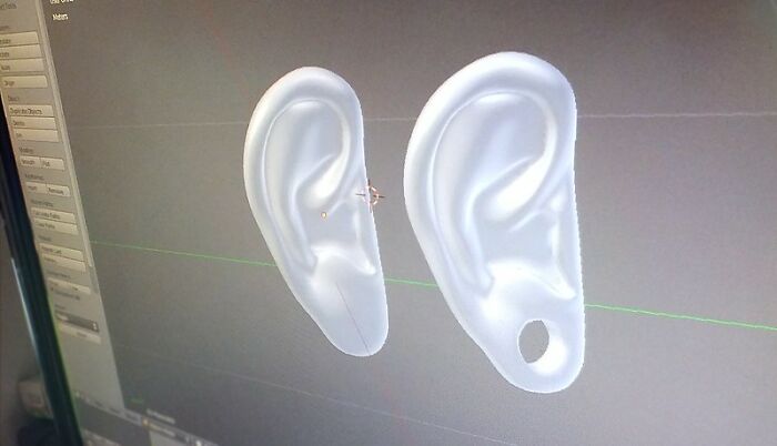 Only People With Rare Body Features Joined This Thread And Shared 35 Of Their Body Anomalies Only People With Rare Body Features Joined This Thread And Shared 35 Of Their Body Anomalies