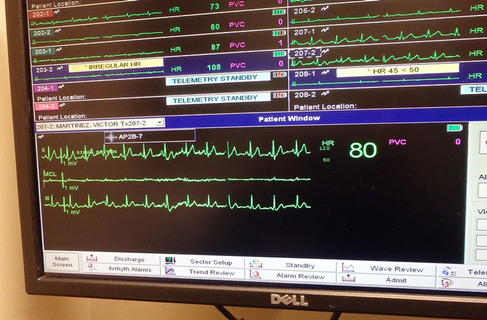 Only People With Rare Body Features Joined This Thread And Shared 35 Of Their Body Anomalies Only People With Rare Body Features Joined This Thread And Shared 35 Of Their Body Anomalies