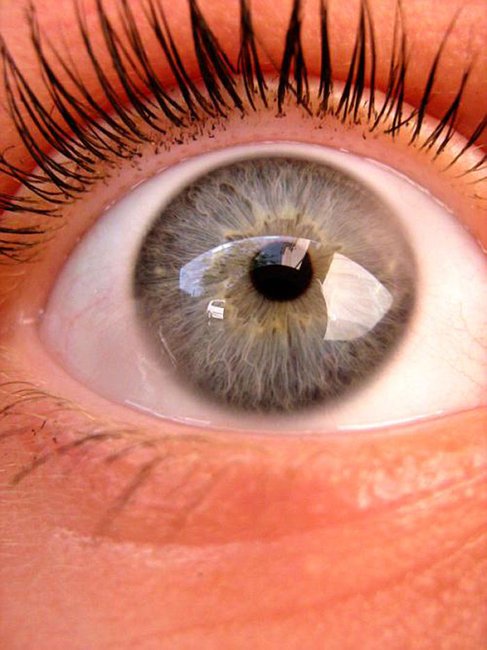 Only People With Rare Body Features Joined This Thread And Shared 35 Of Their Body Anomalies Only People With Rare Body Features Joined This Thread And Shared 35 Of Their Body Anomalies