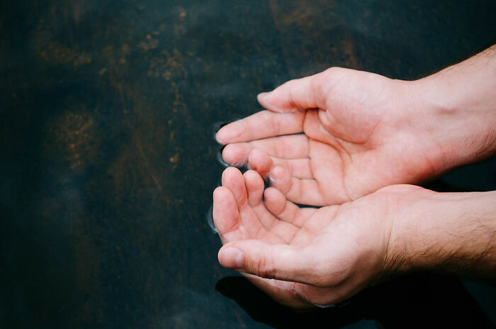 Only People With Rare Body Features Joined This Thread And Shared 35 Of Their Body Anomalies Only People With Rare Body Features Joined This Thread And Shared 35 Of Their Body Anomalies