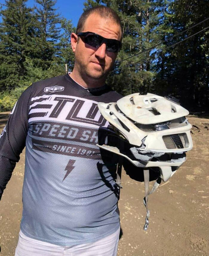 50 Reasons Why Not Wearing A Helmet Is The Dumbest Thing You Can Do (New Pics) 50 Reasons Why Not Wearing A Helmet Is The Dumbest Thing You Can Do (New Pics)