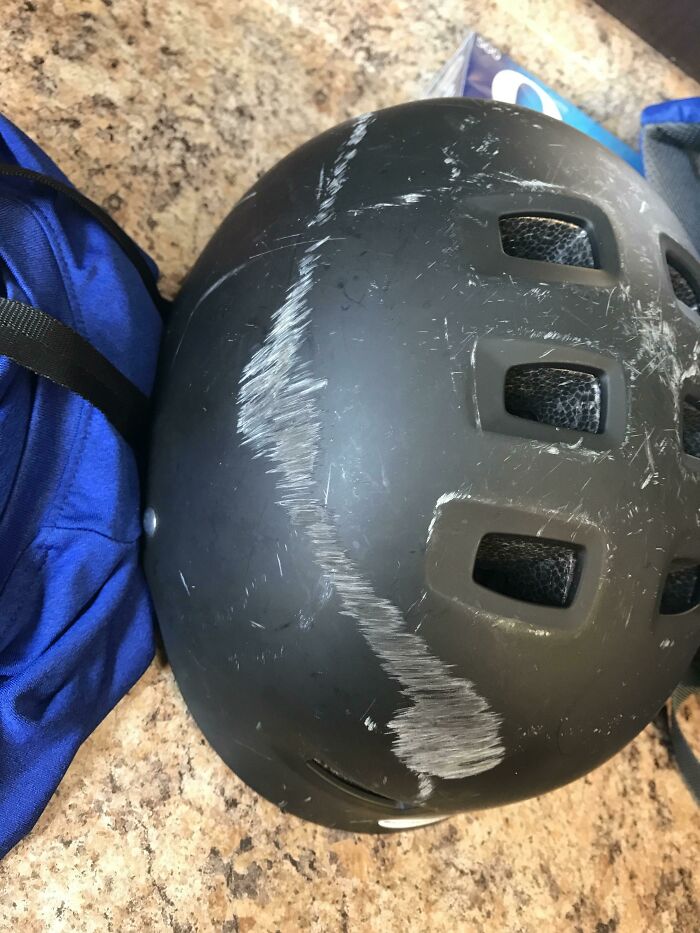 50 Reasons Why Not Wearing A Helmet Is The Dumbest Thing You Can Do (New Pics) 50 Reasons Why Not Wearing A Helmet Is The Dumbest Thing You Can Do (New Pics)