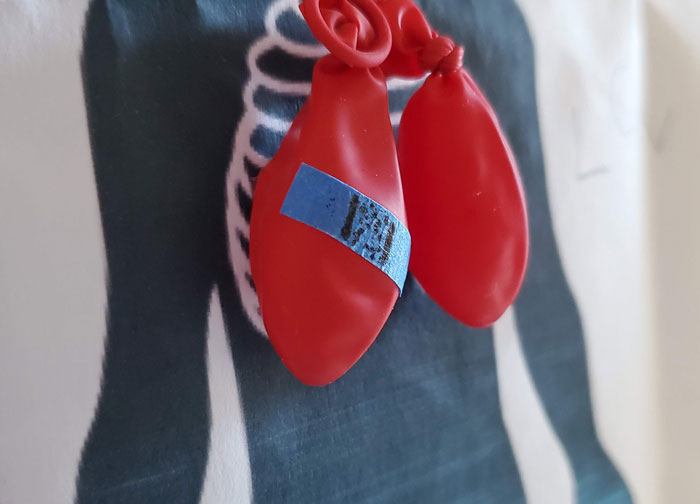 Person Asks “Doctors, What Was The Worst Thing You’ve Seen In A Patient That Another Doctor Overlooked?”, And 30 Folks Deliver Person Asks “Doctors, What Was The Worst Thing You’ve Seen In A Patient That Another Doctor Overlooked?”, And 30 Folks Deliver