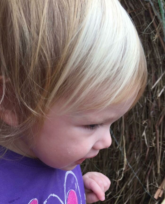 50 Photos Of Unique People That Show That Genetics Is Hard To Predict (New Pics) 50 Photos Of Unique People That Show That Genetics Is Hard To Predict (New Pics)