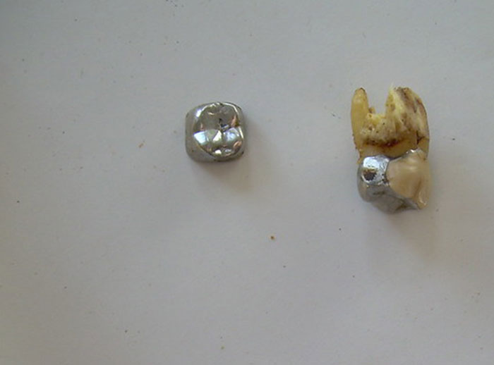 30 Brilliant Stories About The Coolest Things People Found While Using Metal Detectors 30 Brilliant Stories About The Coolest Things People Found While Using Metal Detectors