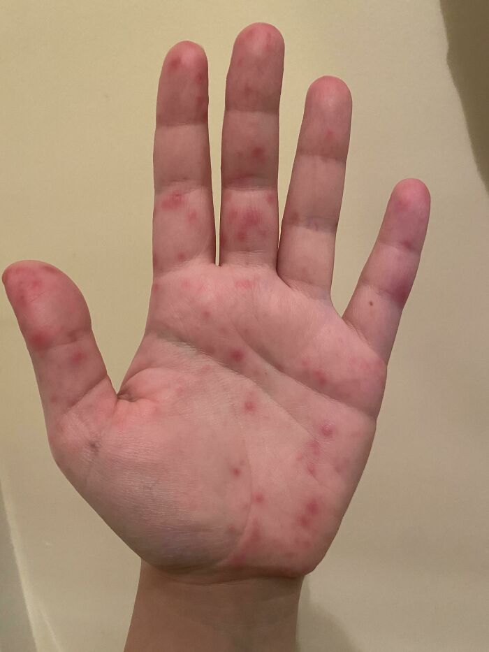 32 People Who Had A Worse Thanksgiving Day Than You