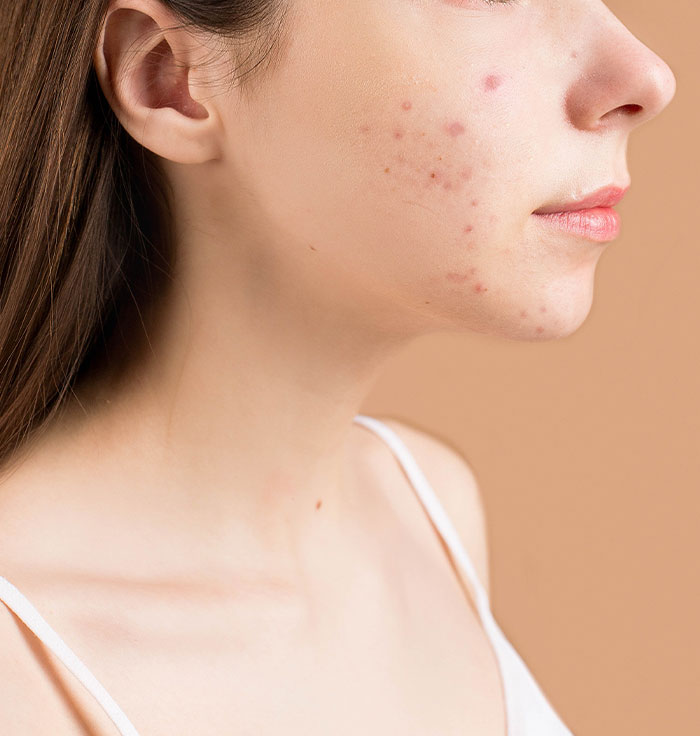 30 Times People Lost The Gene Lottery, According To This Viral Thread 30 Times People Lost The Gene Lottery, According To This Viral Thread