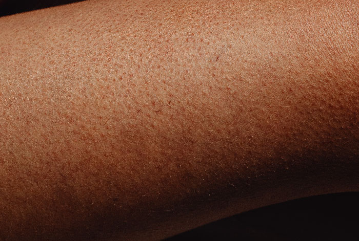 30 Times People Lost The Gene Lottery, According To This Viral Thread 30 Times People Lost The Gene Lottery, According To This Viral Thread