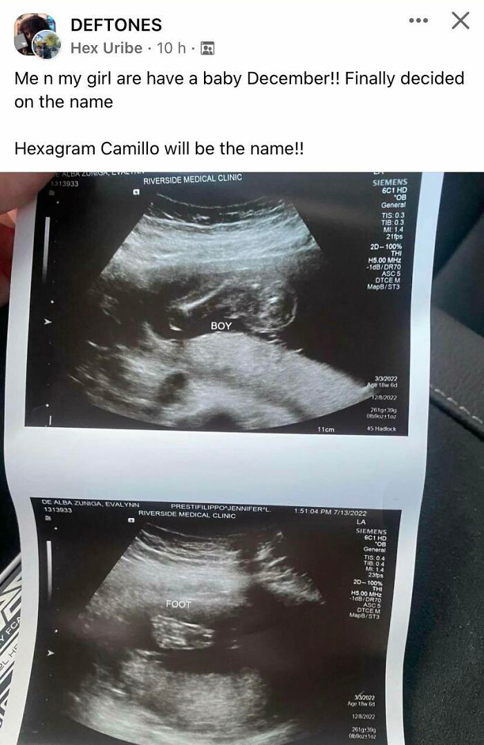 People In This Facebook Group Are Sharing Hilariously Unfortunate Names Parents Actually Give Their Children, Here Are 30 Of The Worst Ones (New Pics) People In This Facebook Group Are Sharing Hilariously Unfortunate Names Parents Actually Give Their Children, Here Are 30 Of The Worst Ones (New Pics)