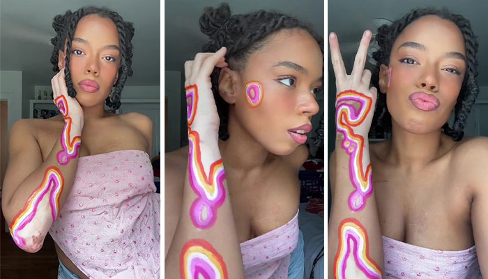 Woman Matches The Color Of The Paint She Outlines Her Vitiligo Spots With To Her Outfits, And People Can’t Get Enough Woman Matches The Color Of The Paint She Outlines Her Vitiligo Spots With To Her Outfits, And People Can’t Get Enough