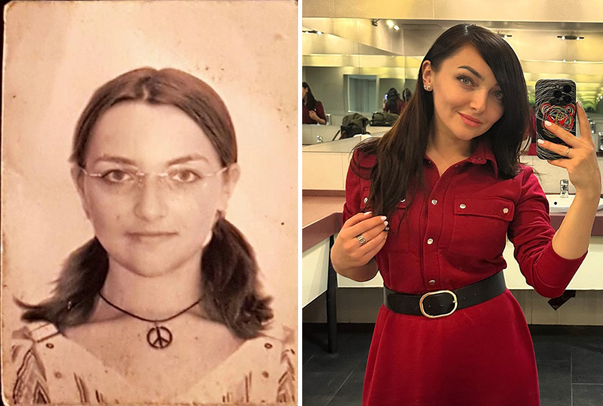 30 Times People Went Through “Ugly Duckling” Transformations And Shared Their Results To Inspire Others 30 Times People Went Through “Ugly Duckling” Transformations And Shared Their Results To Inspire Others