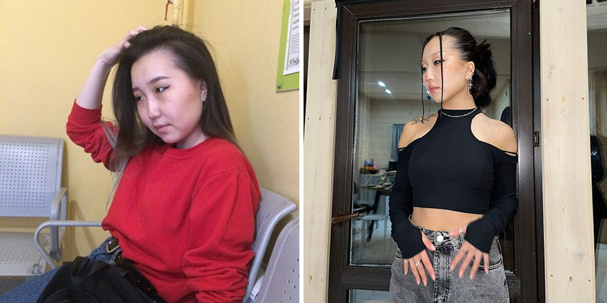 30 Times People Went Through “Ugly Duckling” Transformations And Shared Their Results To Inspire Others 30 Times People Went Through “Ugly Duckling” Transformations And Shared Their Results To Inspire Others