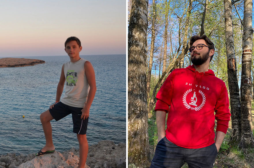 30 Times People Went Through “Ugly Duckling” Transformations And Shared Their Results To Inspire Others 30 Times People Went Through “Ugly Duckling” Transformations And Shared Their Results To Inspire Others