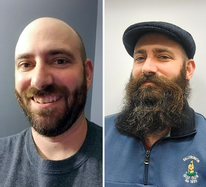 “Puberty Hit You Like A Truck”: These 50 Pics Of Men Before And After Beards May Show Just What You’ve Been Missing In Your Life (New Pics) “Puberty Hit You Like A Truck”: These 50 Pics Of Men Before And After Beards May Show Just What You’ve Been Missing In Your Life (New Pics)