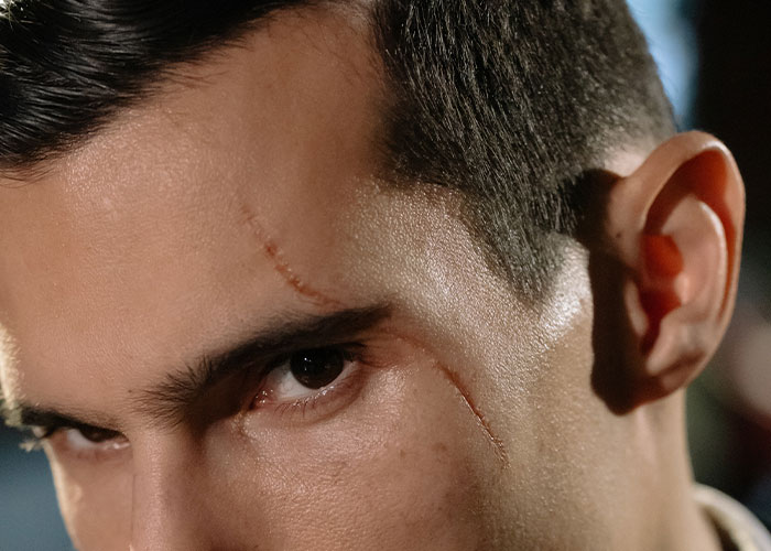 “My Feet Look More Like Paws Than Human Feet”: 35 People Confess What Body Anomalies They Have “My Feet Look More Like Paws Than Human Feet”: 35 People Confess What Body Anomalies They Have