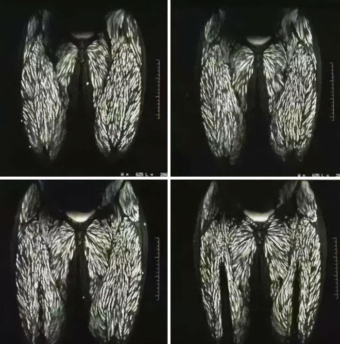 40 Bizarre And Inspiring Medical Cases That People Shared On This Online Community (New Pics) 40 Bizarre And Inspiring Medical Cases That People Shared On This Online Community (New Pics)