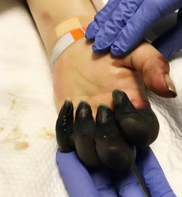 40 Bizarre And Inspiring Medical Cases That People Shared On This Online Community (New Pics) 40 Bizarre And Inspiring Medical Cases That People Shared On This Online Community (New Pics)