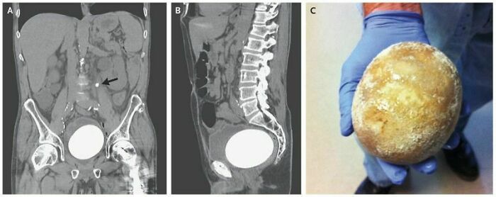40 Bizarre And Inspiring Medical Cases That People Shared On This Online Community (New Pics) 40 Bizarre And Inspiring Medical Cases That People Shared On This Online Community (New Pics)