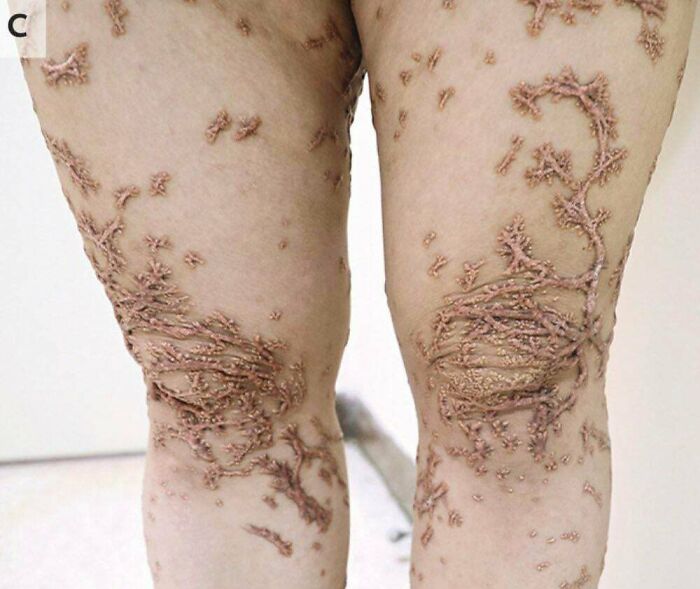 40 Bizarre And Inspiring Medical Cases That People Shared On This Online Community (New Pics) 40 Bizarre And Inspiring Medical Cases That People Shared On This Online Community (New Pics)