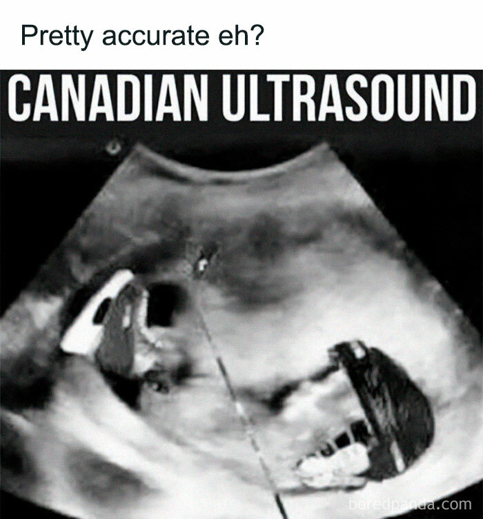 “Only In Canada”: 30 Memes And Posts That Perfectly Describe The Country “Only In Canada”: 30 Memes And Posts That Perfectly Describe The Country