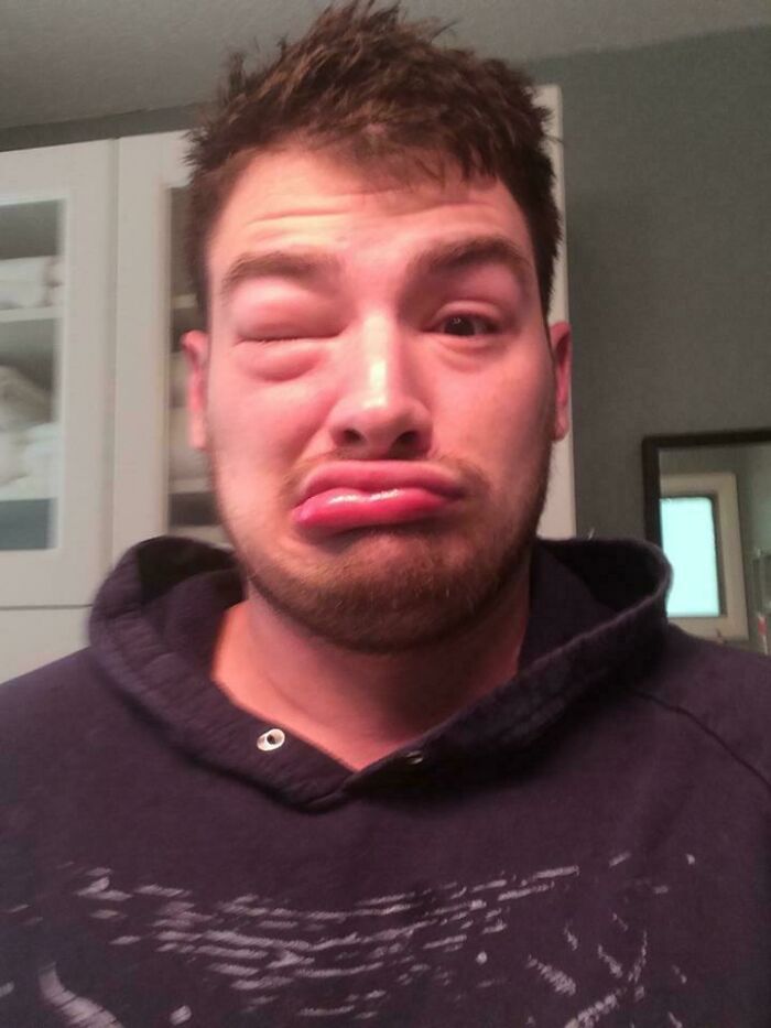 50 Of The Most Unfortunate Things That People Were Forced To Deal With (New Pics)