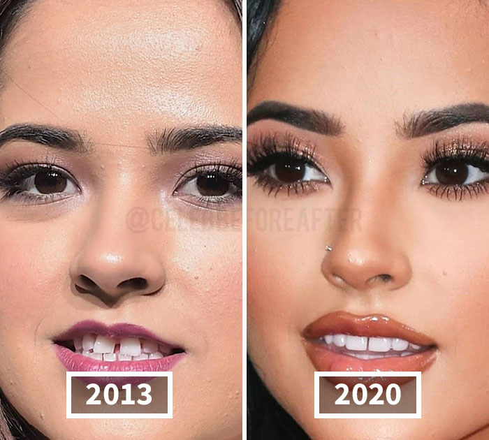 34 Pics That Show How Much Or How Little Celebrity Faces Have Changed Over The Years (New Pics)