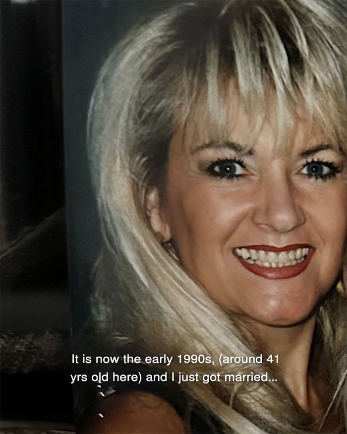 Woman Shares Her Aging Progress And How She Looks After Getting A Facelift At 70 Years Old Woman Shares Her Aging Progress And How She Looks After Getting A Facelift At 70 Years Old