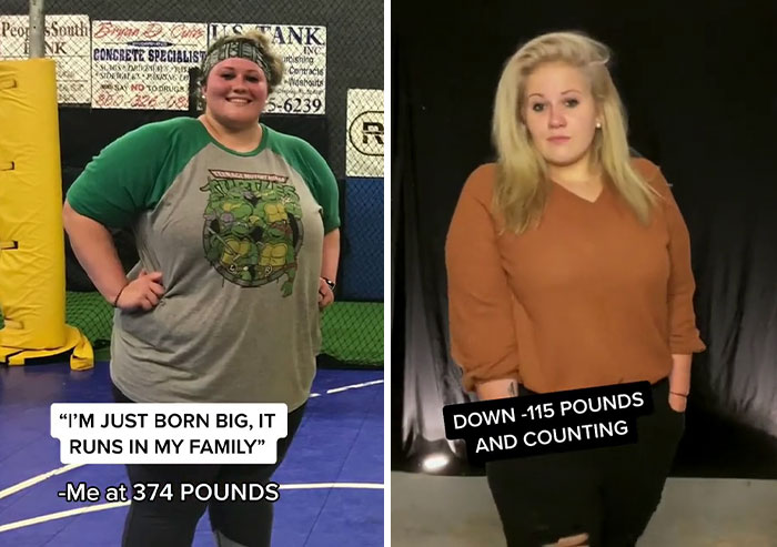 People Who Were Picked On And Bullied For Their Looks Reveal Their Jaw-Dropping Transformations People Who Were Picked On And Bullied For Their Looks Reveal Their Jaw-Dropping Transformations